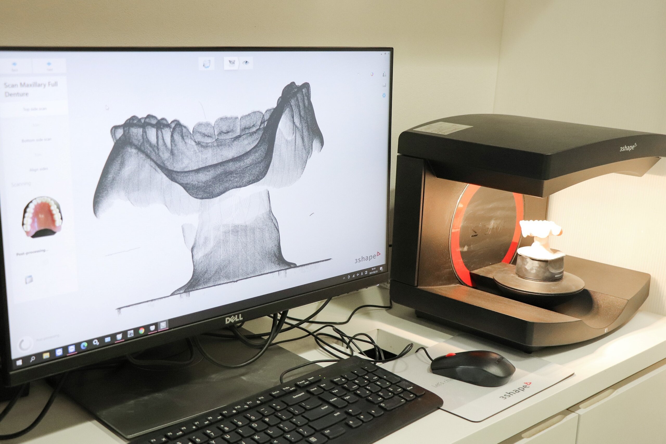 入れ歯をデータ化する様子　出展：お守り入れ歯社